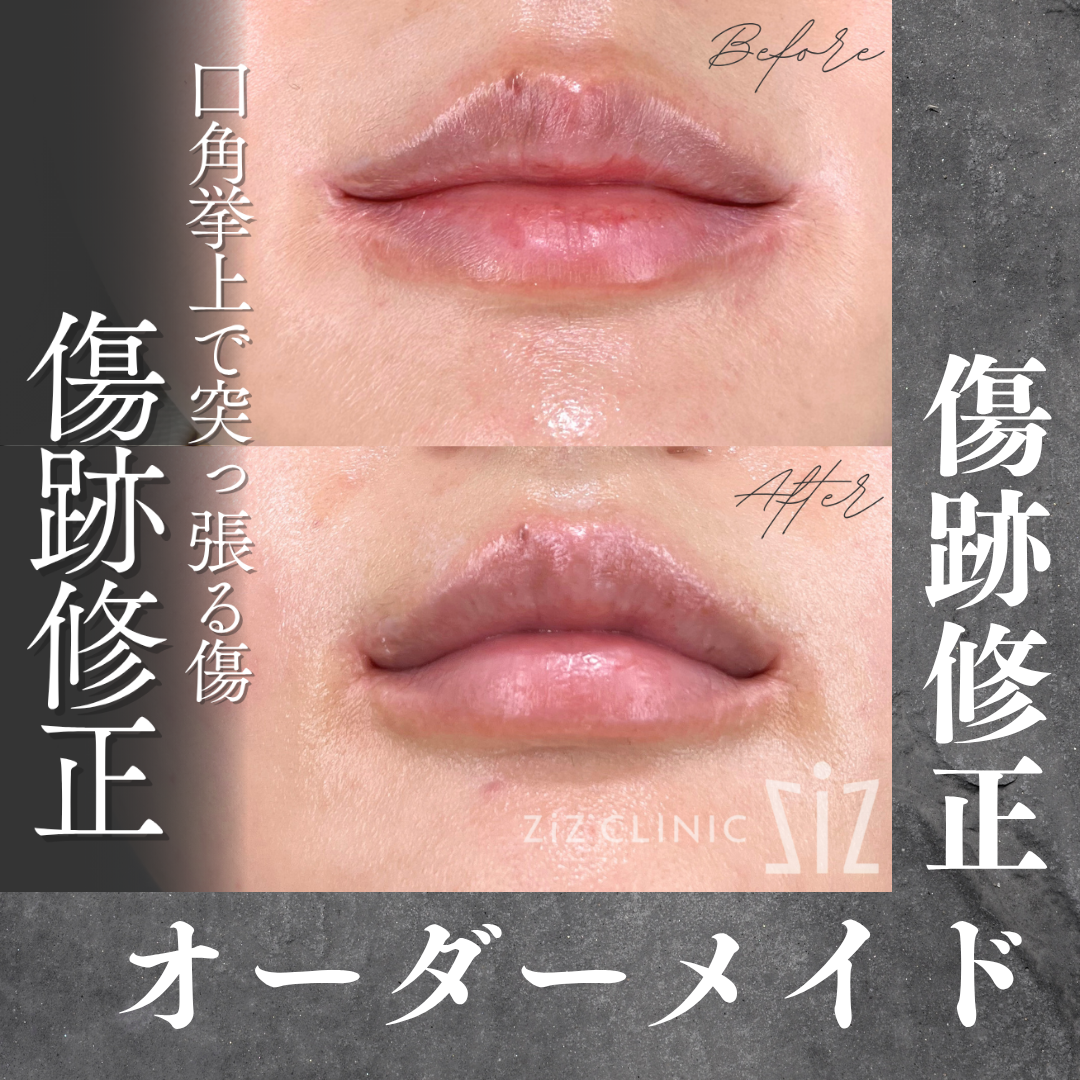 施術効果