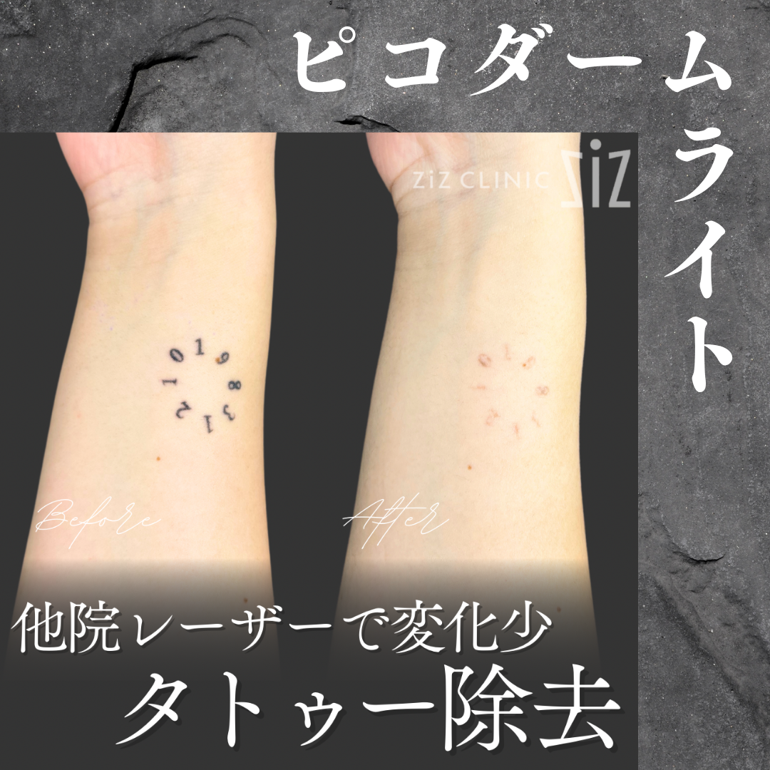 施術効果