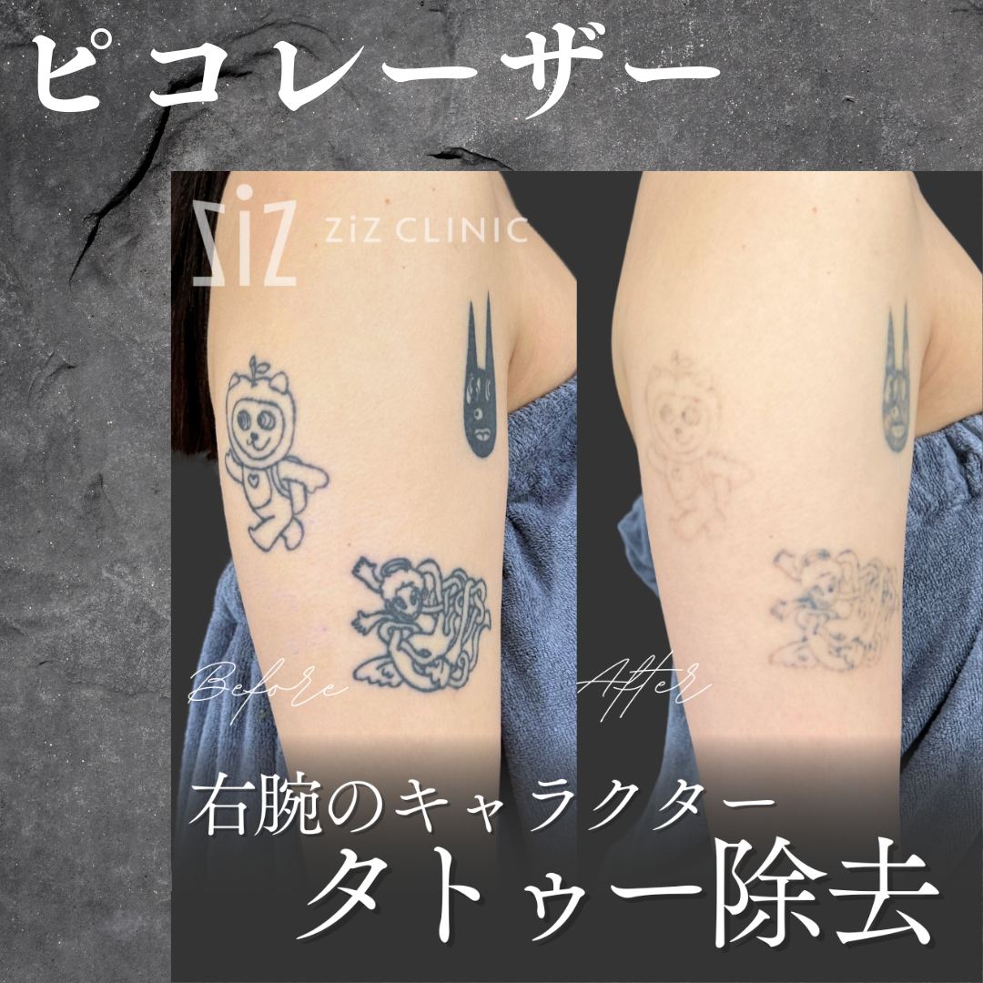 施術効果