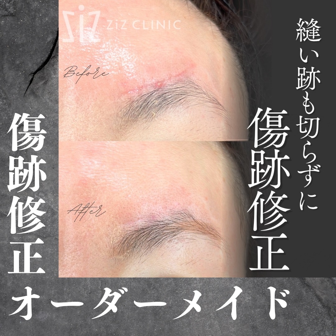 施術効果
