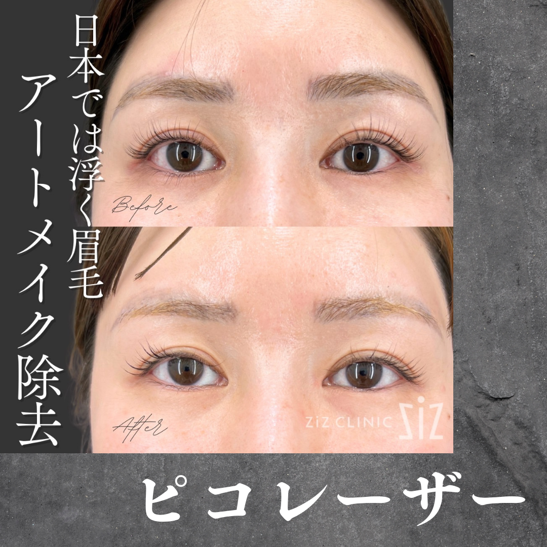 施術効果