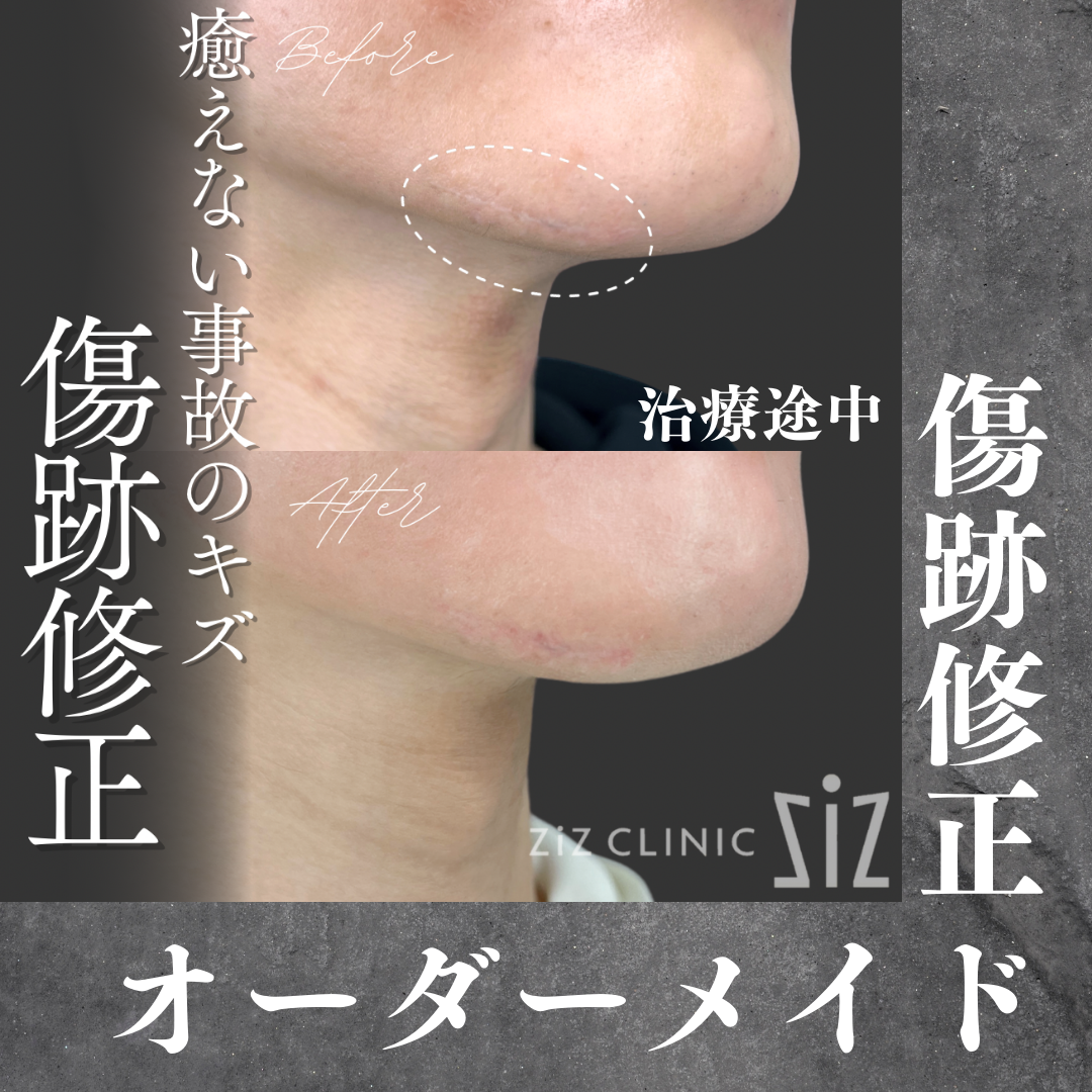 施術効果