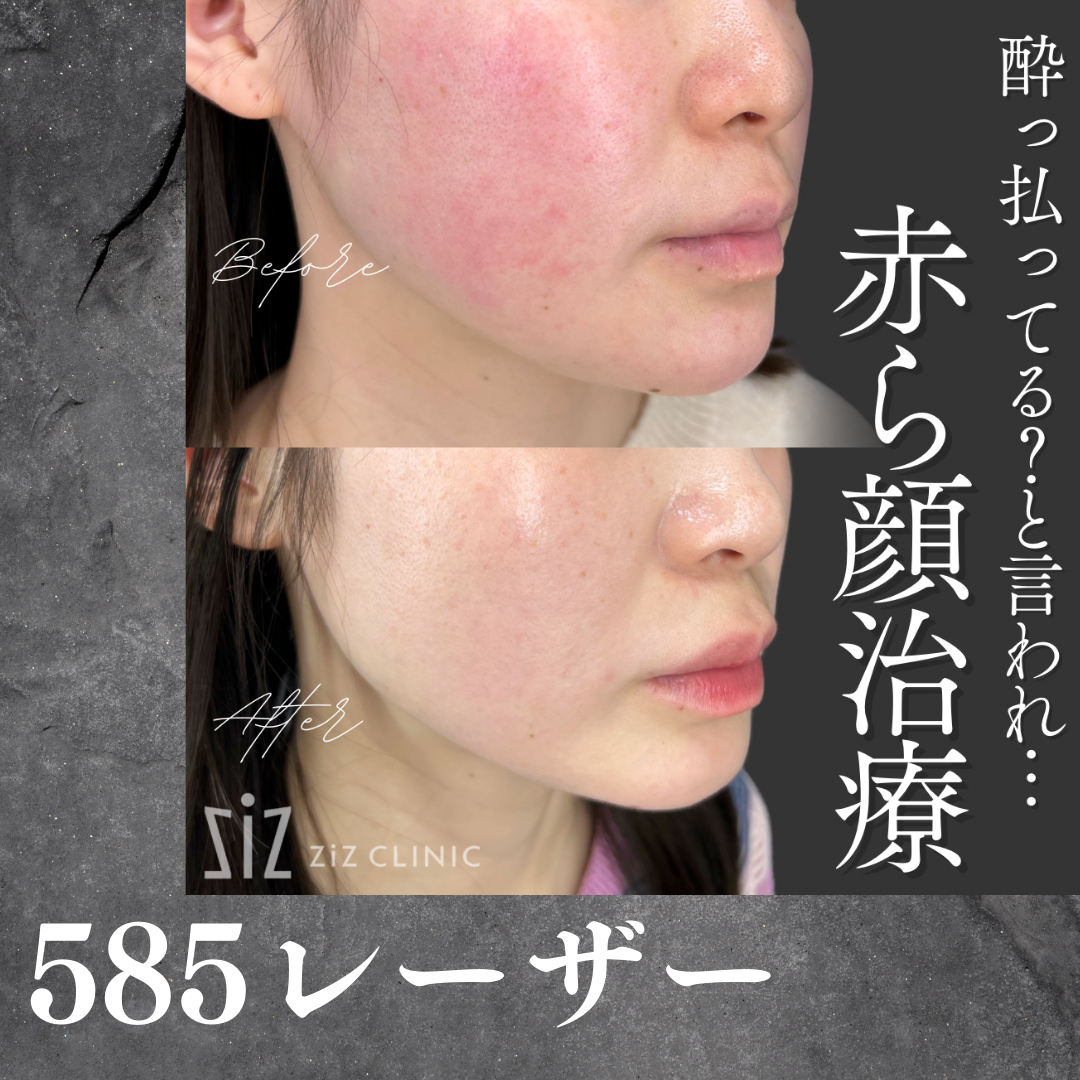 施術効果