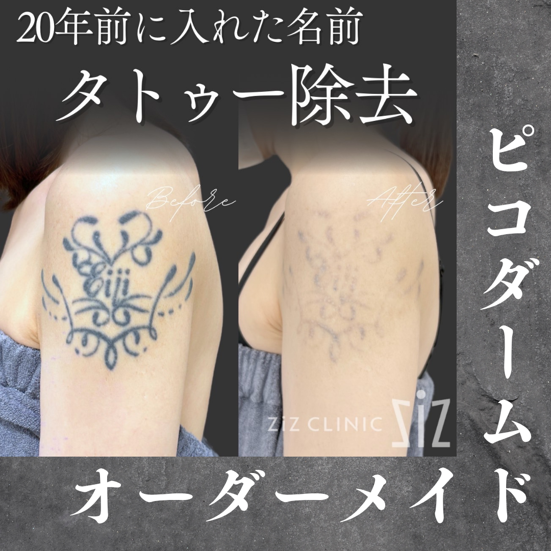 施術効果