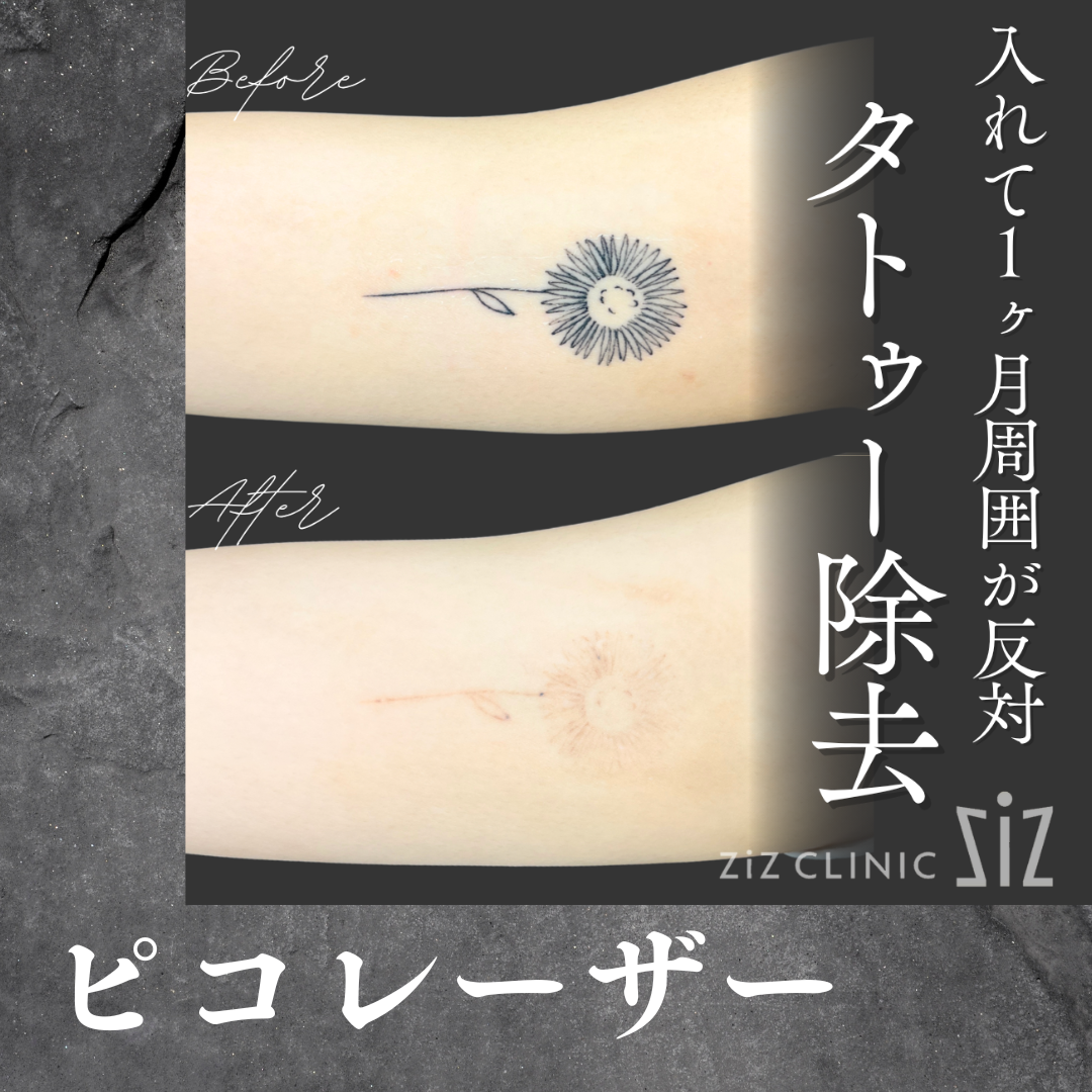 施術効果