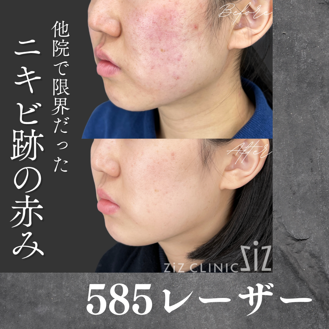 施術効果