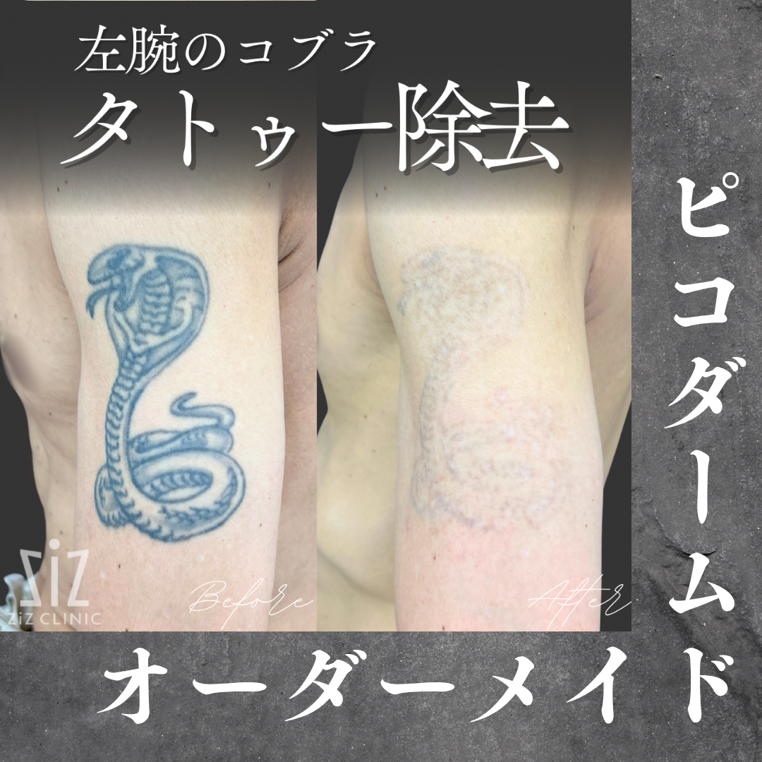 施術効果