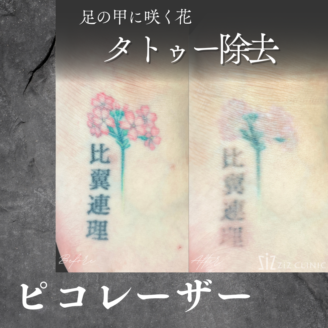 施術効果