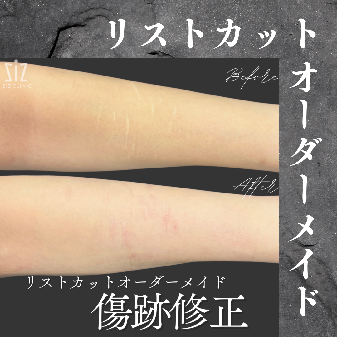施術効果