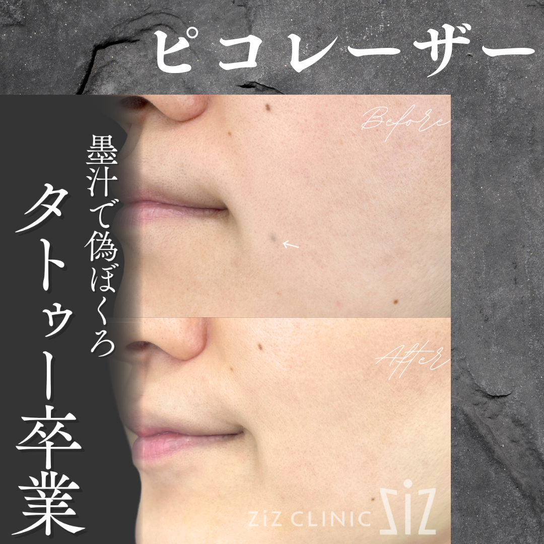 施術効果