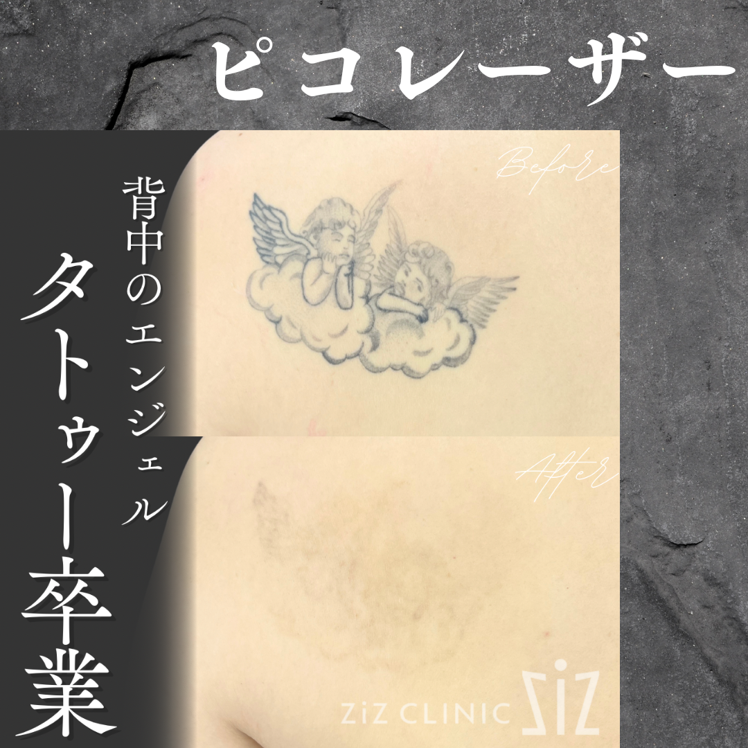 施術効果