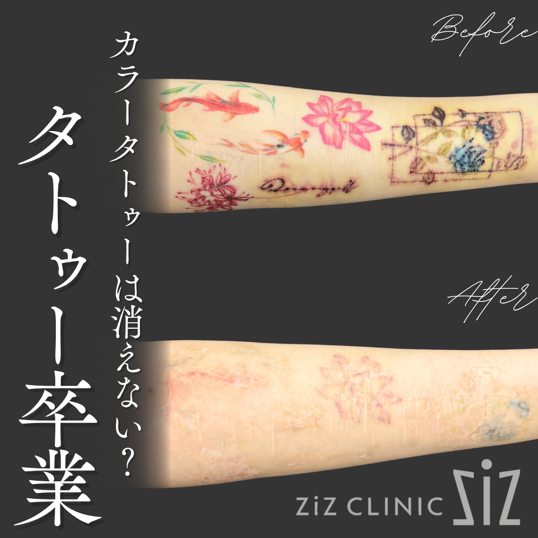 施術効果