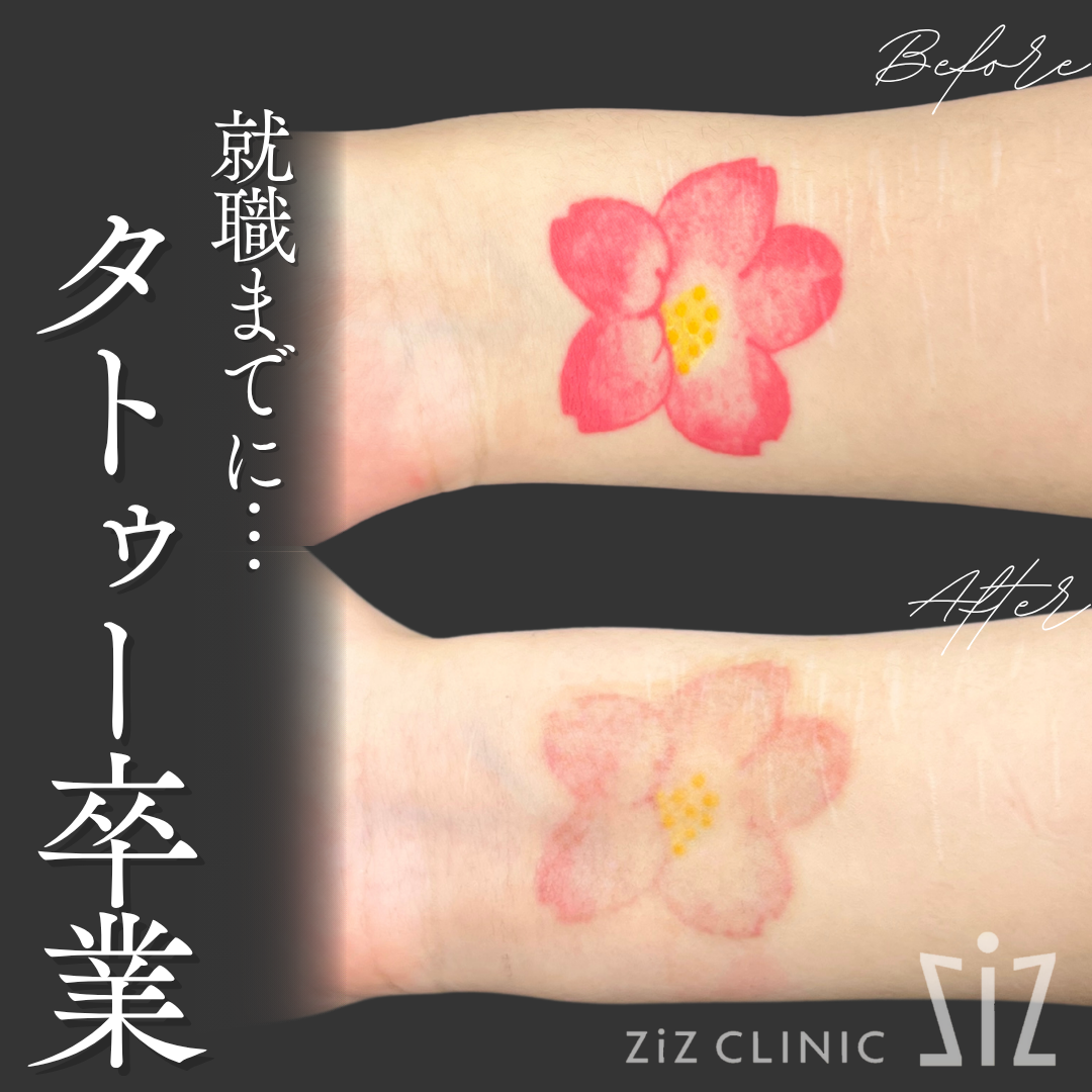 施術効果