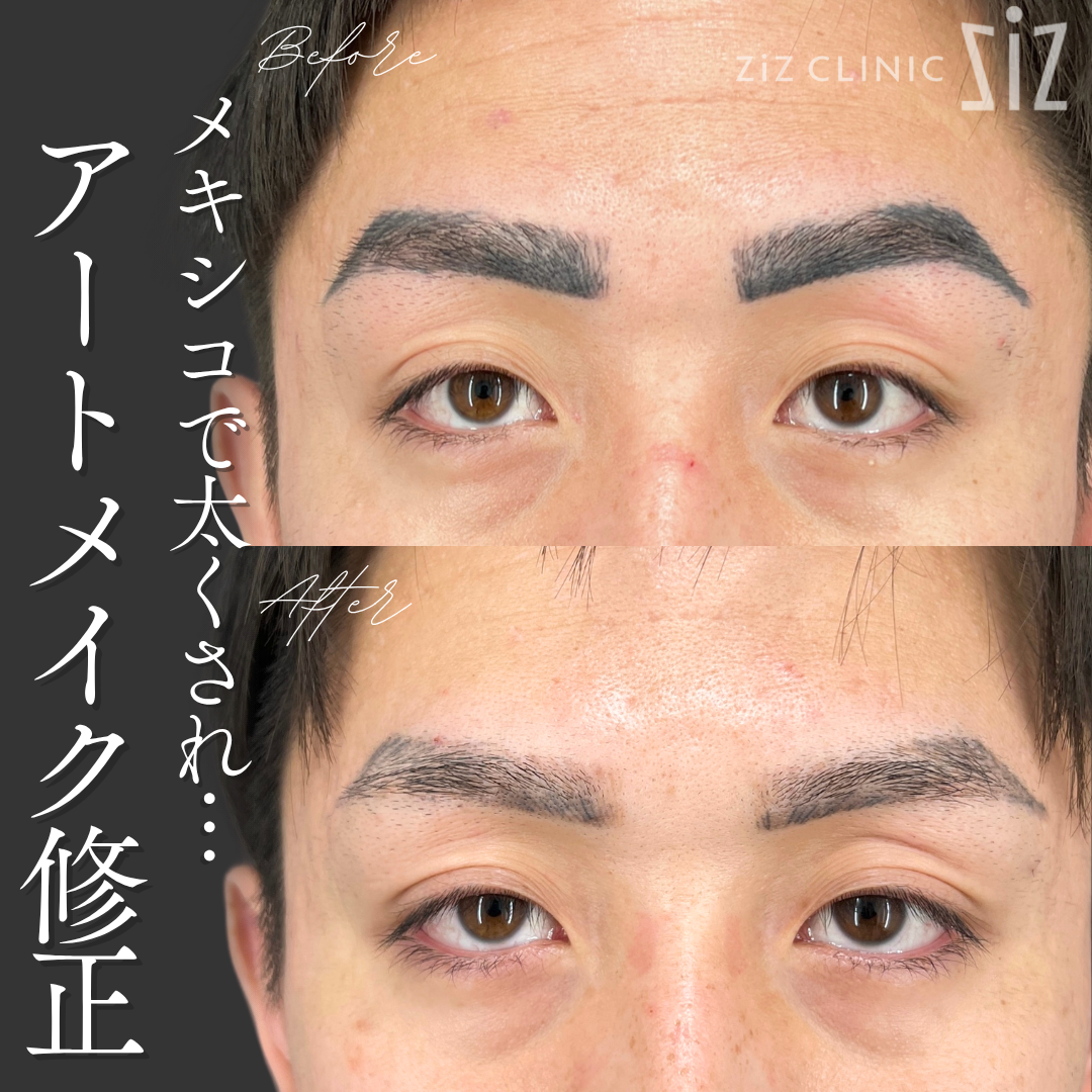 施術効果