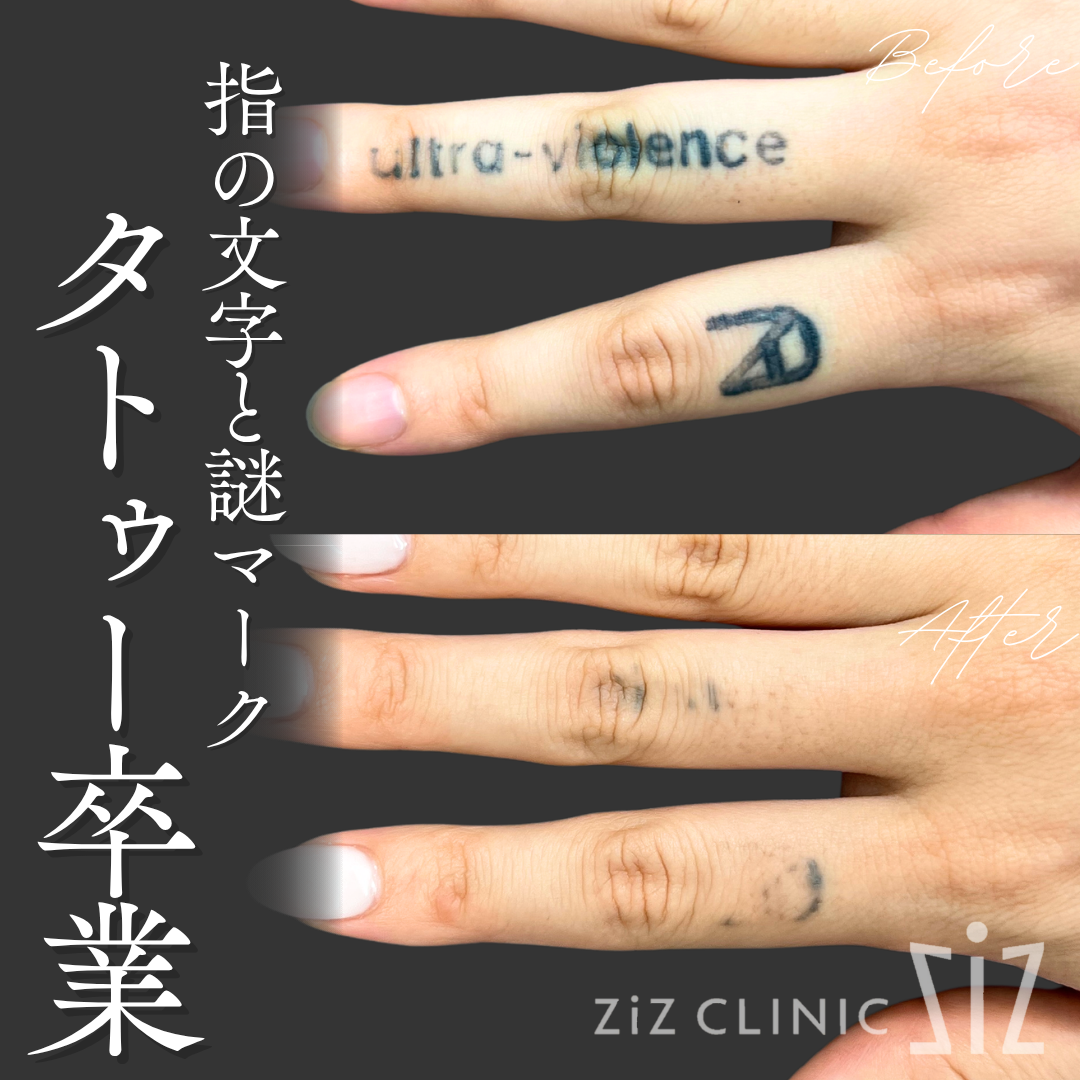 施術効果