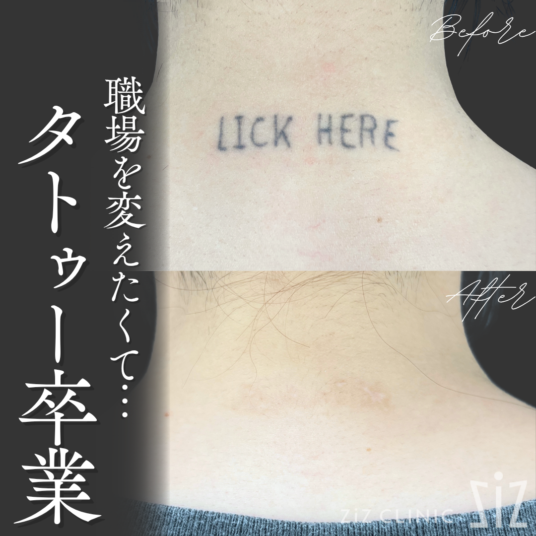 施術効果