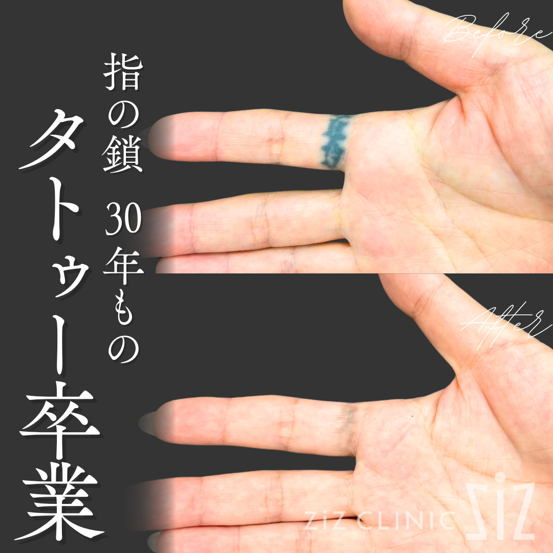 施術効果