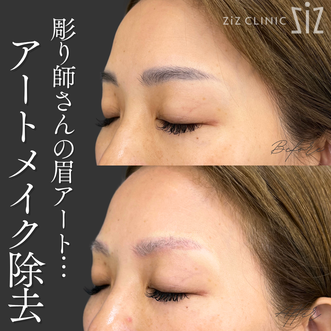 施術効果