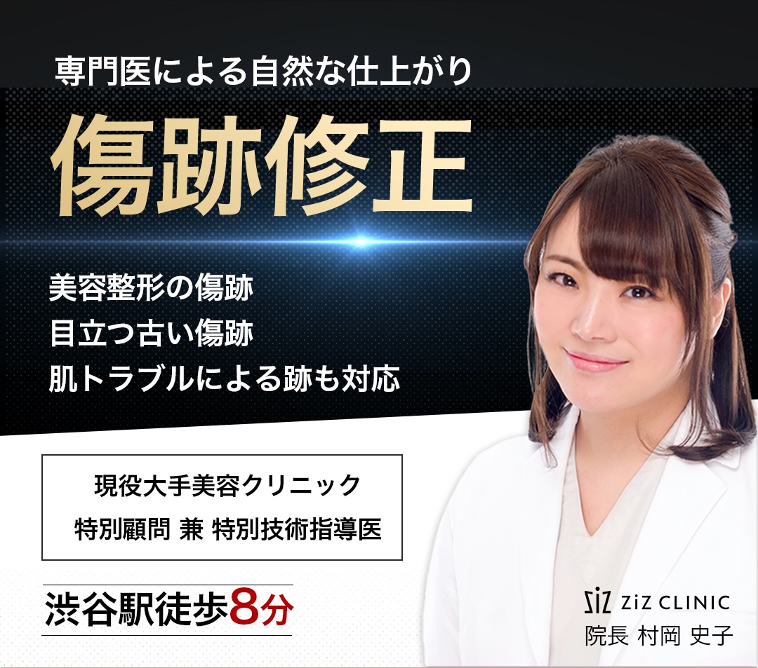 傷跡修正N-DERM