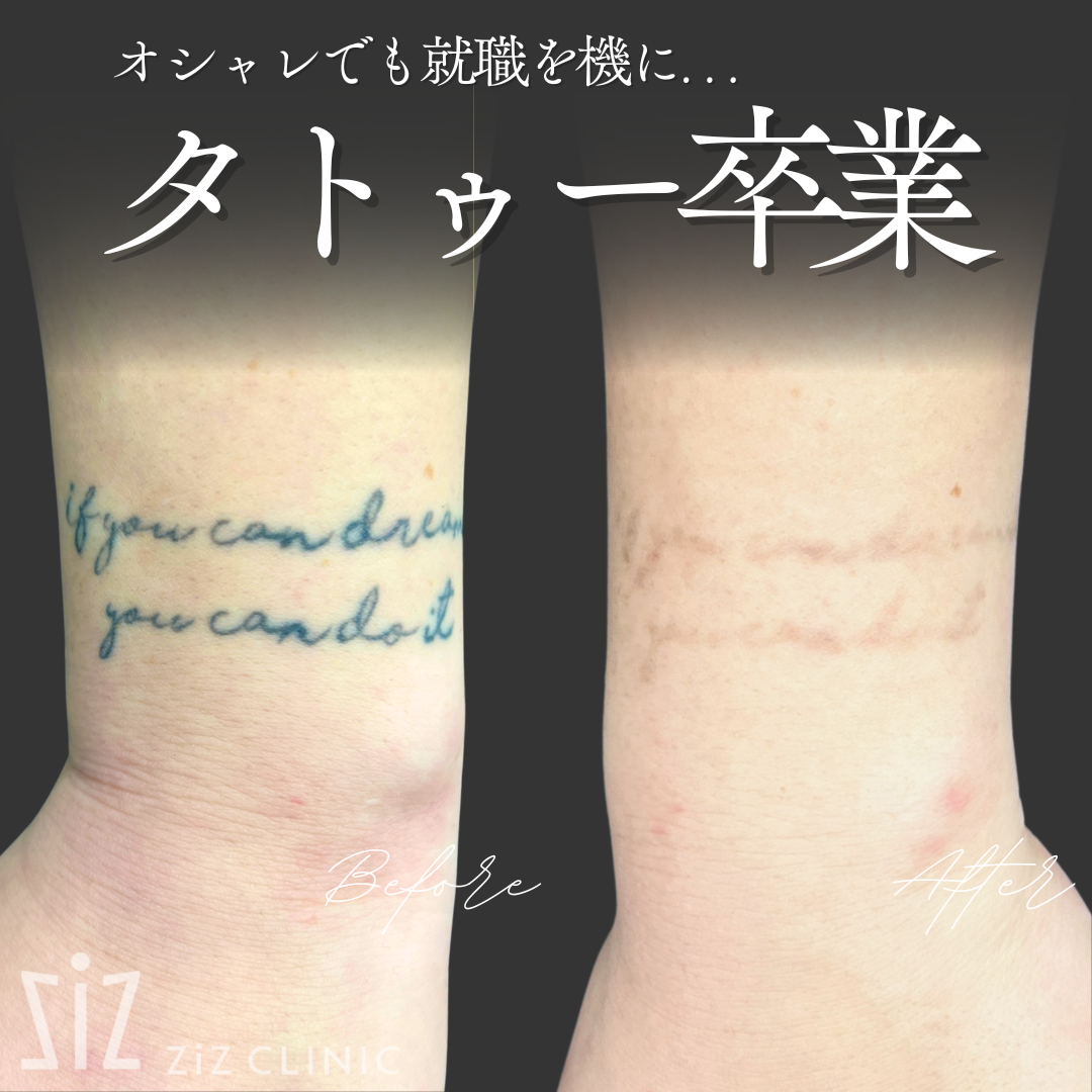 施術効果